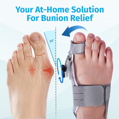 Eslicer™ Bunion Fix US