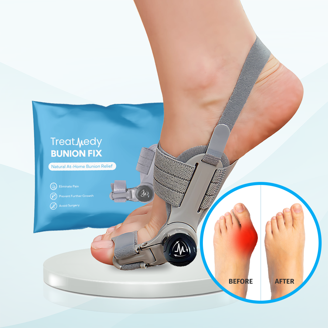 Eslicer™ Bunion Fix