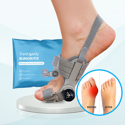Eslicer™ Bunion Fix US