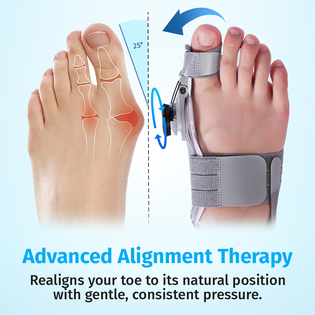 Eslicer™ Bunion Fix